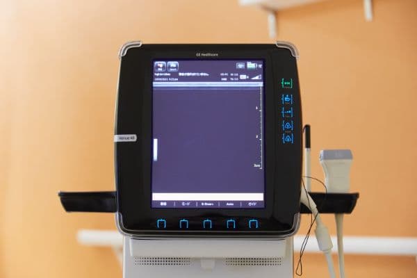 超音波検査装置（エコー）